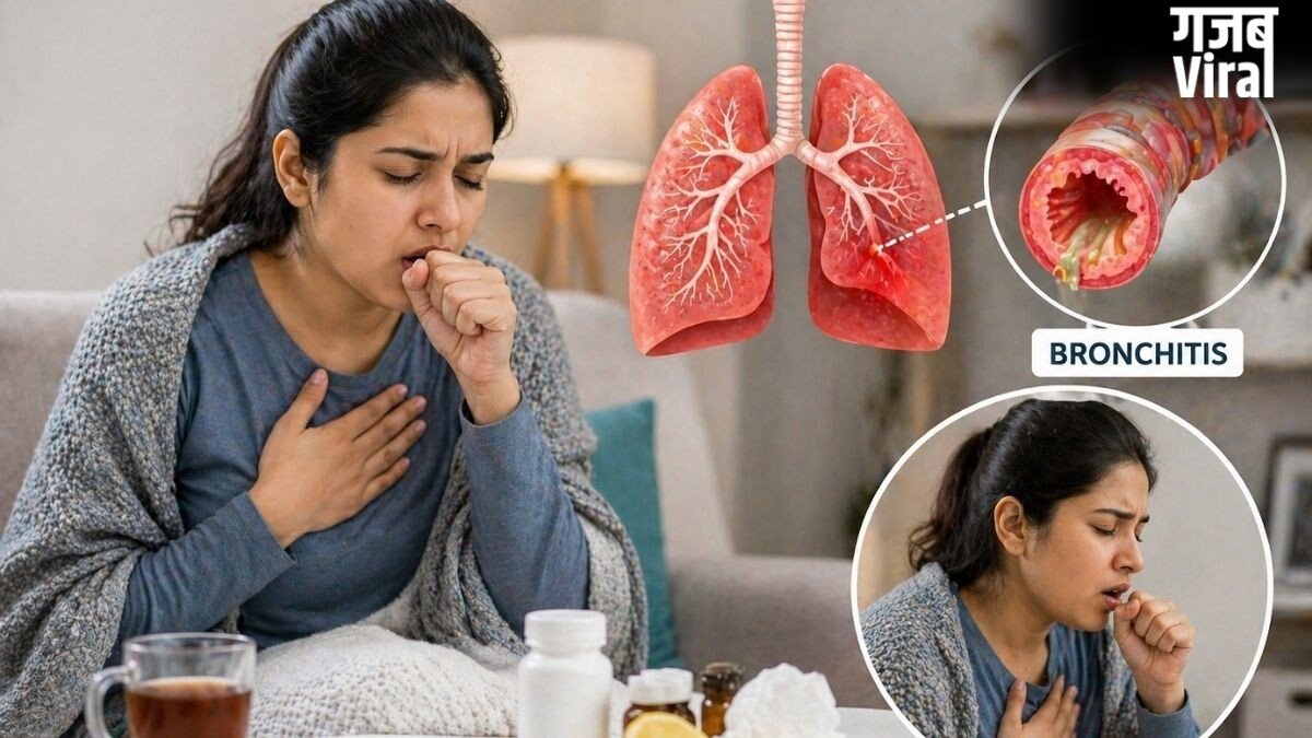हल्का बुखार, लगातार खांसी, खांसी के साथ बलगम ब्रोंकाइटिस के हो सकते हैं लक्षण, डॉक्टर से जानिए बीमारी का कारण, प्रकार और बचाव