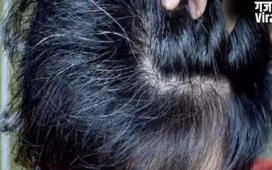 White Hair: बच्चों के बाल सफेद होने की वजह क्या है? जानिए इससे पचने के उपाय