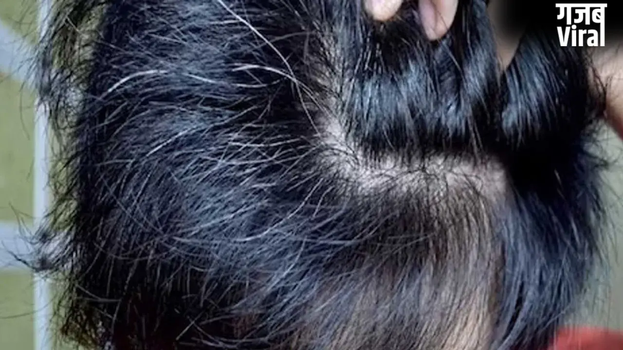 White Hair: बच्चों के बाल सफेद होने की वजह क्या है? जानिए इससे पचने के उपाय
