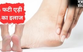 गर्मी में भी फट जाती हैं एड़ियां, इस तरह मुलायम बनाने और दरारें भरने में मिलेगी मदद, बरतें ये सावधानी