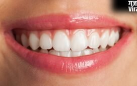 दांतों पर दिखने लगी है पीले रंग की परत, तो अपनाएं ये तरीका, चमक जाएंगे आपके दांत