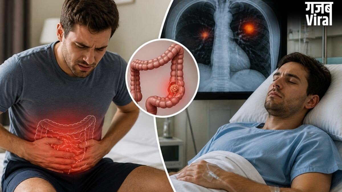 Health Alert: क्या मामूली कब्ज हो सकता है कोलन कैंसर का संकेत? 29 साल के युवक के केस से समझें सारी कहानी