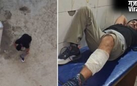 UP: छोटे भाई को फंसाने के लिए खुद को मारी गोली… फिर ऐसे हुआ एक्सपोज, प्रापर्टी को लेकर हुआ था विवाद