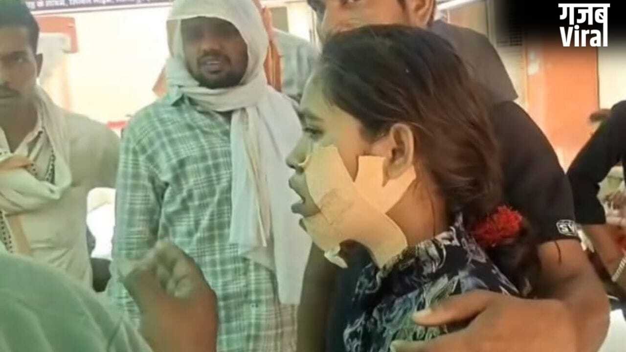 गजब! दर्द था दाएं जबड़े में, डॉक्टर ने कर दिया बाएं का ऑपरेशन… ललितपुर मेडिकल कॉलेज का ये हाल