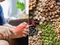 Dal Side Effects: दाल खाने के शौकीन हैं तो हो जाएं सावधान,  यूरिक एसिड बढ़ने पर जहर बन जाती हैं ये दालें​