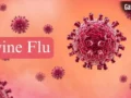Swine Flu Prevention: बारिश के मौसम में क्यों बढ़ जाता है स्वाइन फ्लू का खतरा? जानें कैसे करें बचाव​