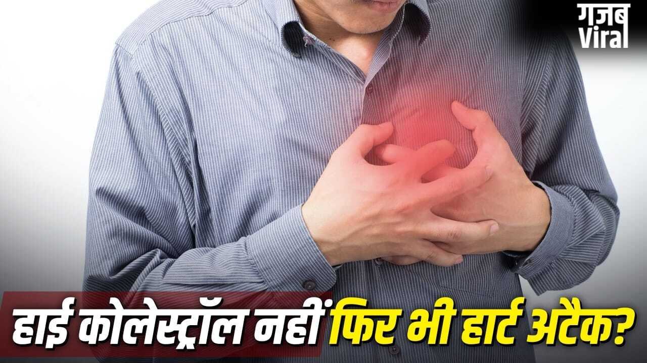क्या बिना हाई कोलेस्ट्रॉल के भी आ सकता है हार्ट अटैक?​
