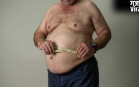 Obesity in Men: पुरुषों में पेट निकलना सिर्फ मोटापा नहीं, हो सकता है यह कारण​