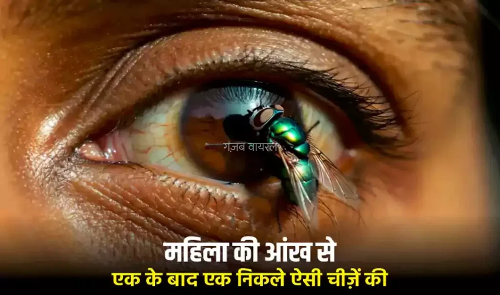 इस महिला की आंख से एक के बाद एक निकले ऐसी चीज़ें की डॉक्टर भी रह गए दंग, आप भी ध्यान दें