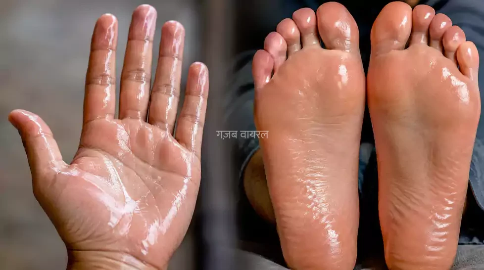 क्या आपको भी आता है हथेली और तलवों में पसीना, तो इस बीमारी के हैं संकेत