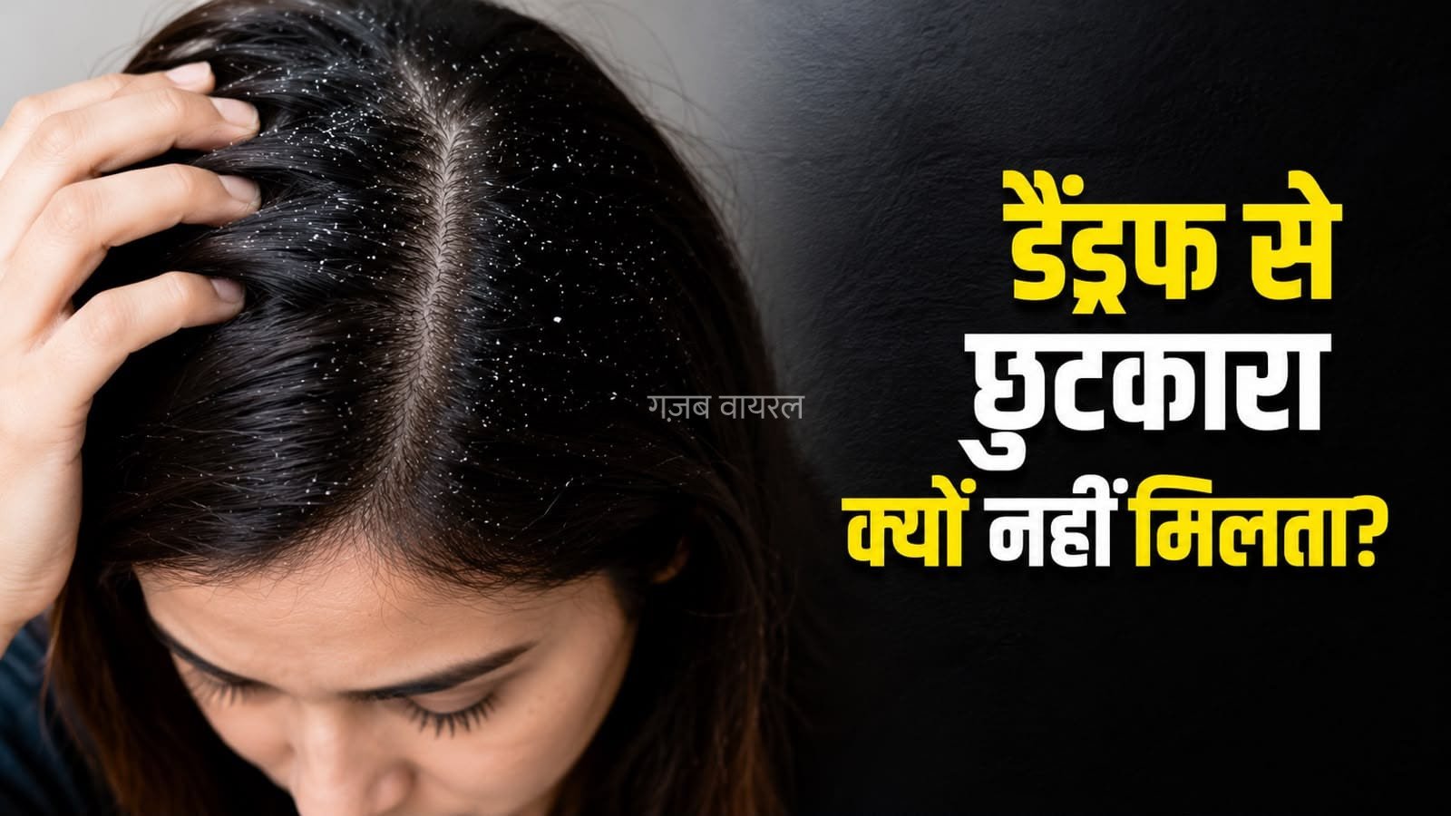 डैंड्रफ का बार-बार लौटना पड़ सकता है भारी, जानें कहां हो रही है गलती
