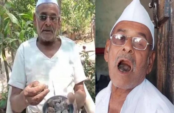 ये हैं 80 साल के पत्थर वाले बाबा, एक दिन में चट कर जाते हैं 250 ग्राम पत्थर