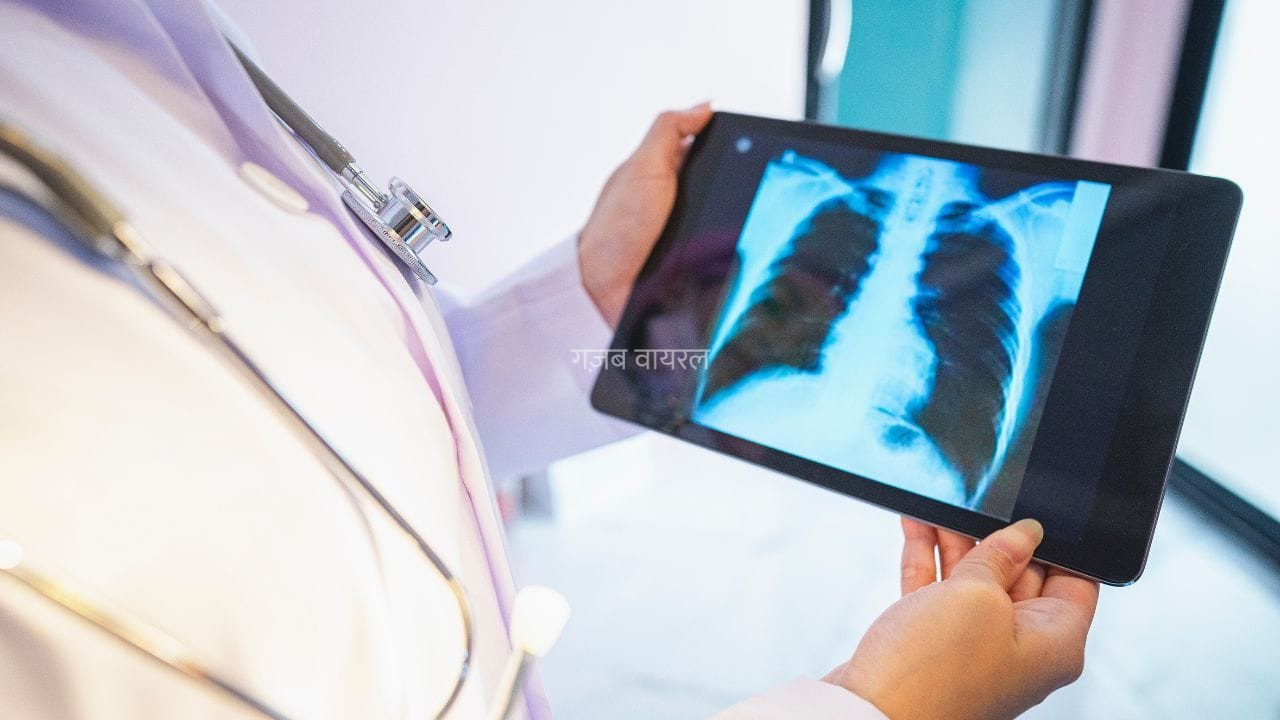 World Lung Cancer Day: किन लोगों को लंग कैंसर स्क्रीनिंग करवानी चाहिए और क्यों? एक्सपर्ट्स ने बताया