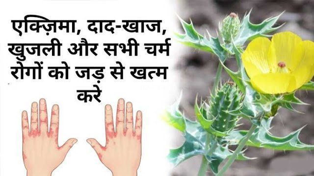 एक्जिमा, दाद खाज, खुजली और सभी चर्म रोगों को जड़ से ख़त्म कर देती है ये ट्रिक​​​