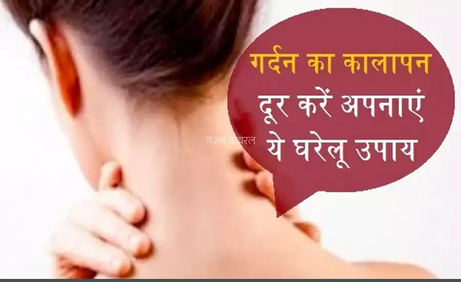 तवे से भी काली गर्दन का कालापन दूर करेंगे ये चमत्कारी घरेलू उपाय, बस सही तरीका होना चाहिए पता