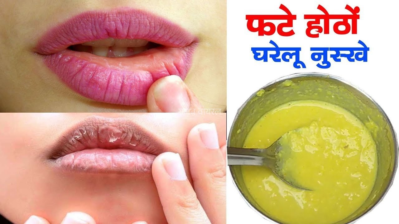 फटे होंठ एक दिन में मुलायम हो जाएंगे, दूध और गुलाब की पत्तियां इस तरह लगाएं​​​
