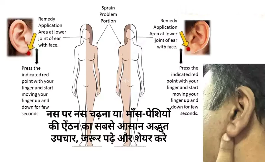 नस पर नस चढ़ना या माँस-पेशियों की ऐंठन का सबसे आसान अद्भुत उपचार, जरूर पढ़े और शेयर करे