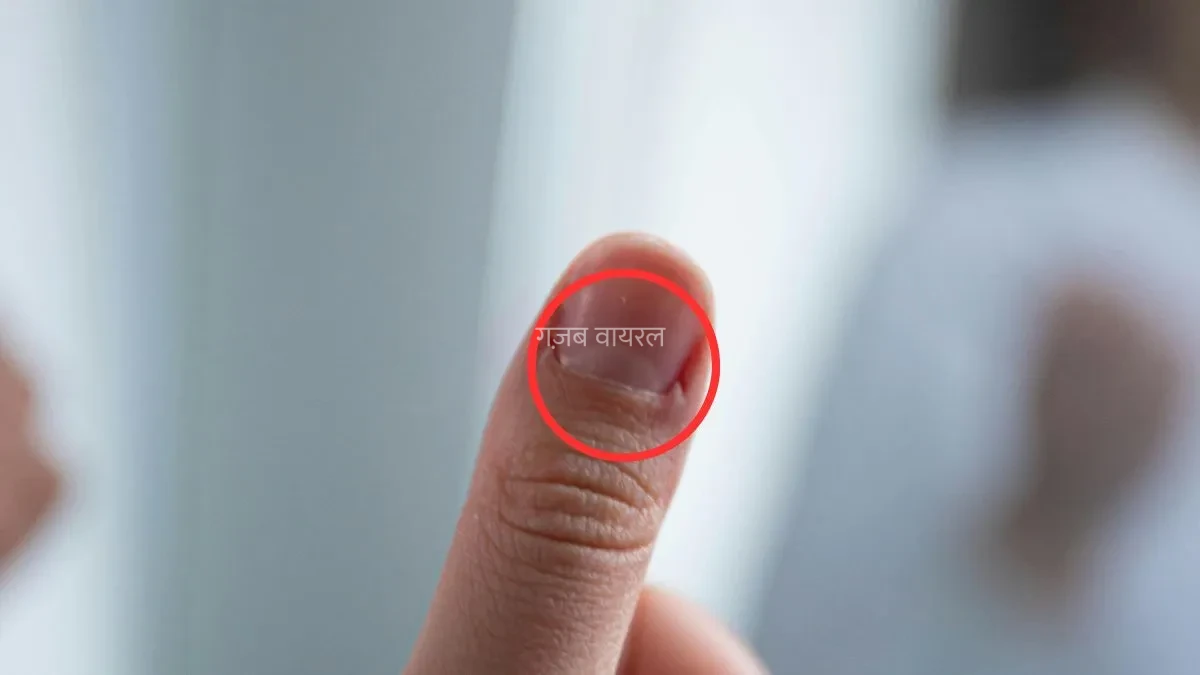 हमारे नाखूनों पर क्यों बनते हैं सफेद निशान? अगर आपके भी है तो आज जान लीजिए कारण​​​