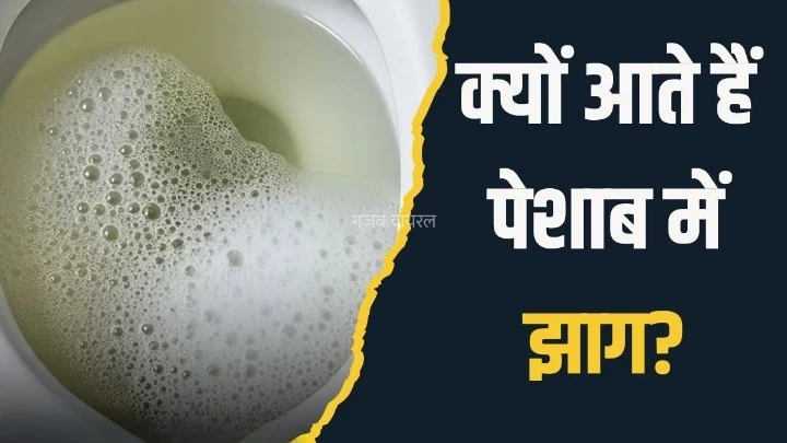 पेशाब में झाग आने का क्या मतलब होता है? आयुर्वेदिक न्यूट्रिशनिस्ट ने बताया क्या करें और कैसे दूर होगी दिक्कत​​​