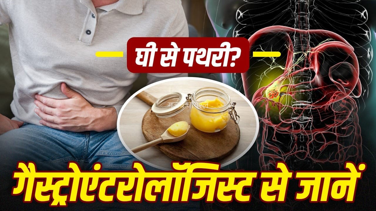 क्या ज्यादा देसी घी खाने से हो जाती है गॉल ब्लैडर में पथरी, गेस्ट्रोएंट्रोलॉजिस्ट से जानें​