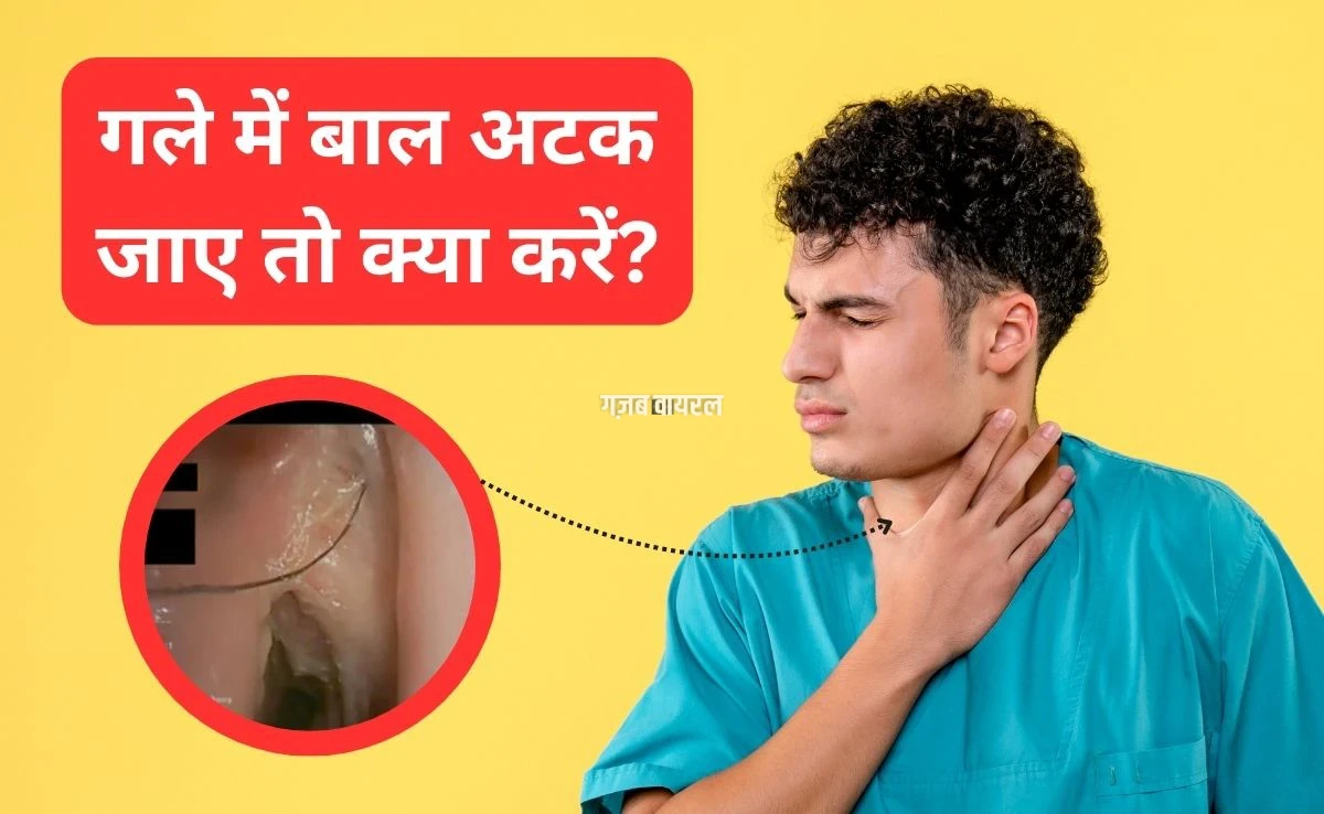गले में बाल फंस जाए तो क्या करना चाहिए? डॉक्टर ने बताया घर पर 2 मिनट में कैसे करें गला साफ