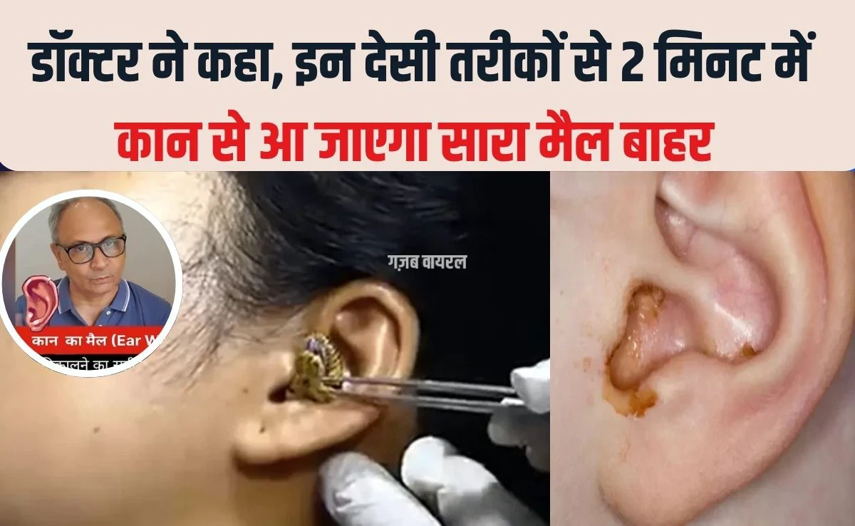 2 म‍िनट में कान का मैल आ जाएगा बाहर, सरसों के तेल में बस यह सफेद चीज म‍िलाकर डालें