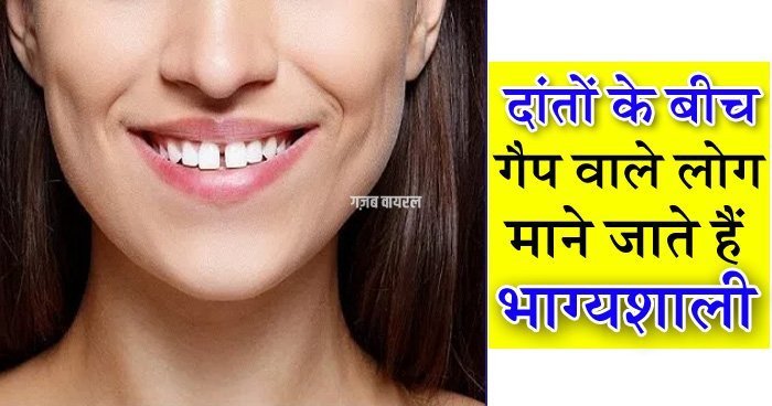 teeth-gap-09.06.19-2